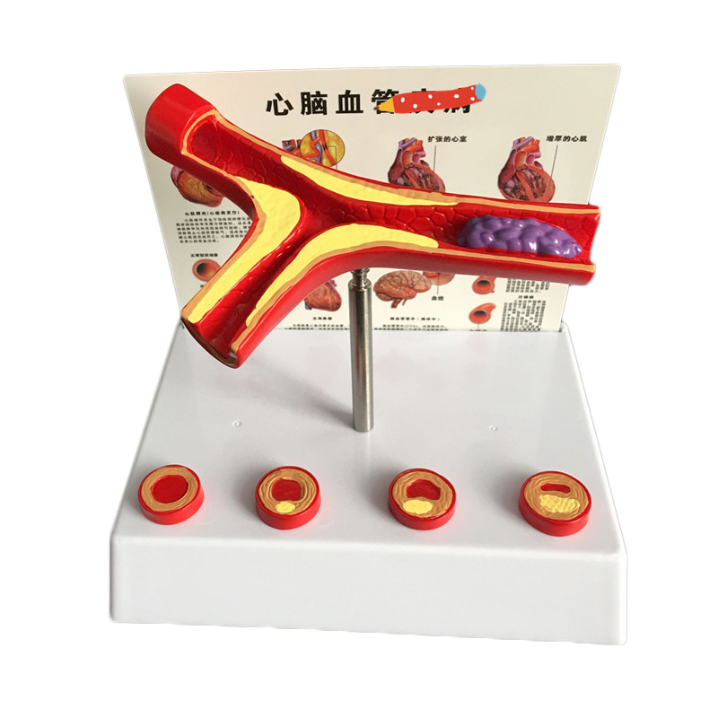 50 Times Enlarged Human Vessel - Medical Lab And Science ulasan dan harga