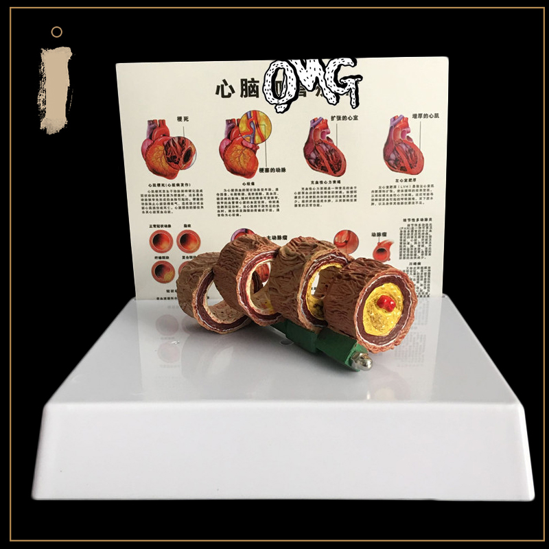 50 Times Enlarged Human Vessel - Medical Lab And Science ulasan dan harga